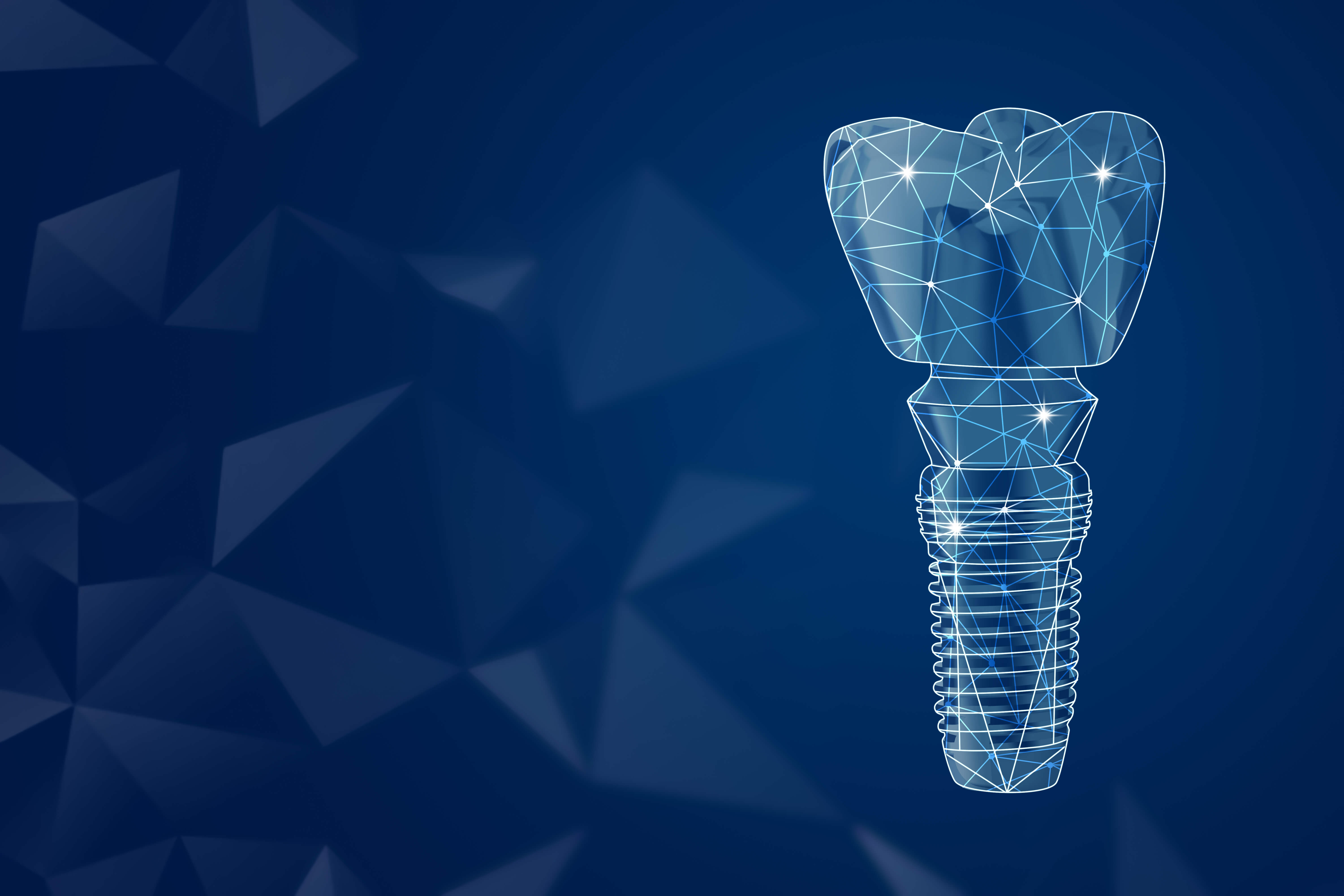 dental implant